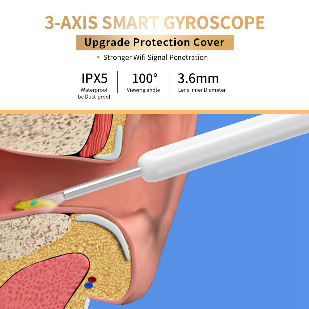 Wireless Ear Cleaner Camera – Otoscope Ear Wax Removal Tool