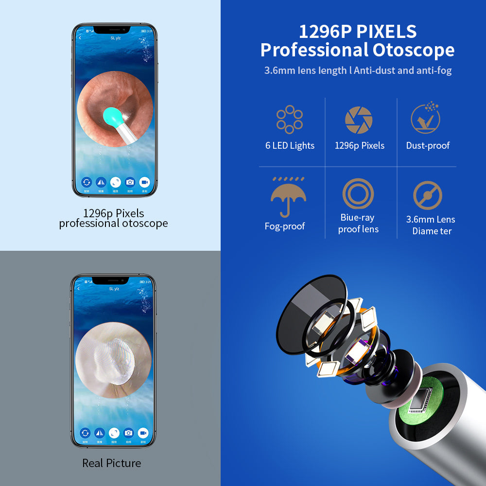 Wireless Ear Cleaner Camera – Otoscope Ear Wax Removal Tool